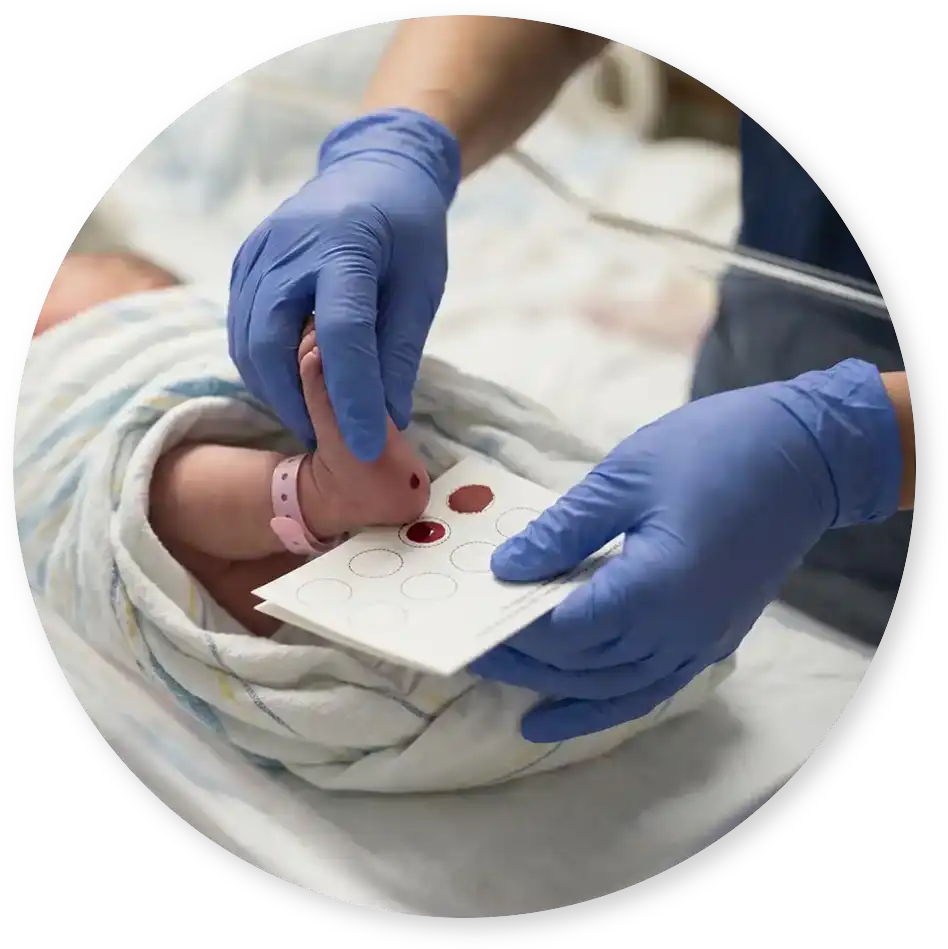 A newborn's heel is pricked for a few drops of blood on a screening card