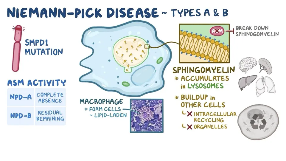 Video: Niemann-Pick Disease Types A and B, from NORD